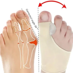 جهاز تصحيح و تقويم إصبع القدم